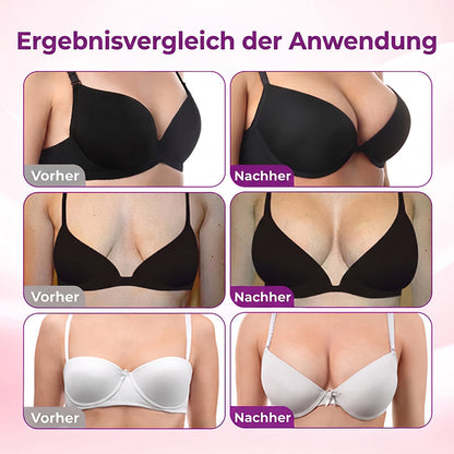 Turonu® Nano-Mikronadel-Pflaster für eine gezielte Brustpflege und ein verbessertes Hautgefühl 🍀