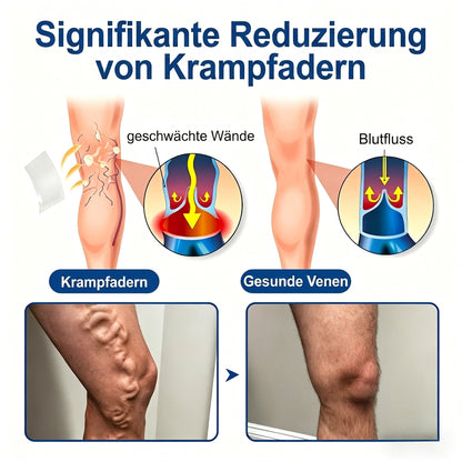 Offizieller Markenstore 30% 𝑭𝒍𝐨𝐫𝒊𝘀𝒎𝙖® 𝑽𝒆𝒊𝒏𝑻𝒂𝒓𝒈𝒆𝒕 𝑴𝒊𝒌𝒓𝒐𝒏𝒂𝒅𝒆𝒍-𝑷𝒇𝒍𝒂𝒔𝒕𝒆𝒓 ⚡ Sofortige Linderung, langfristige Wirkung🎁🎁