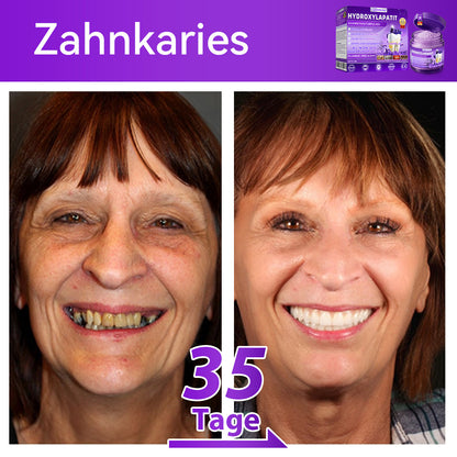 Dormorna®🎁 Herzlichen Glückwunsch! Sie sind einer unserer glücklichen Gewinner! 💪 Als unser exklusiver Glücksstern erhalten Sie jetzt unglaubliche 30% Rabatt! Verpassen Sie nicht diese einmalige Gelegenheit, sich etwas Besonderes zu gönnen!